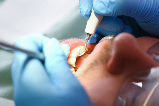 Best Emergency Dental Care for Abscessed Tooth in Gregory, TX