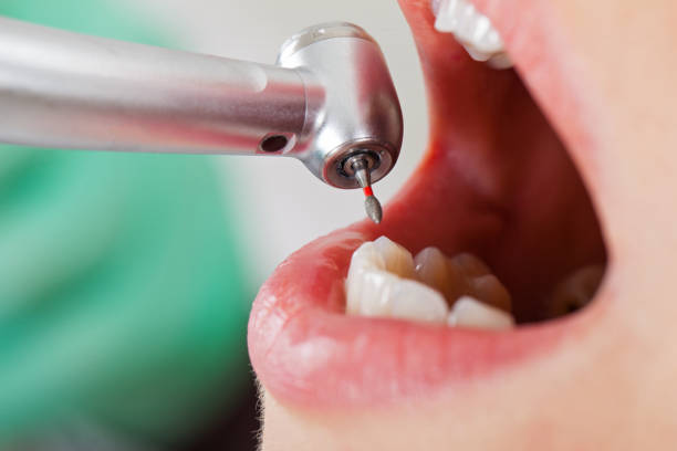 Best Pediatric Emergency Dentist in Gregory, TX